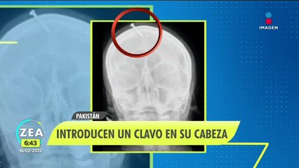Clavan clavo en cabeza de una embarazada para que tenga un varón