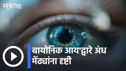 Australia | ऑस्ट्रेलियन शात्रज्ञांनी दृष्टिहीनांसाठी एक नवी अशा जागवली | Sakal |