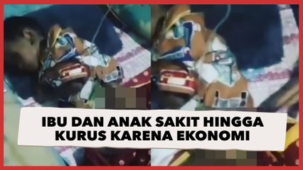 Ibu dan Anak Yatim di Bekasi Sakit hingga Kurus karena Desakan Ekonomi, Kondisinya Menyayat Hati