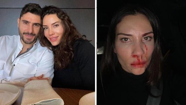 Özer Hurmacı ve Mihriban Hurmacı arasındaki şiddet soruşturması tamamlandı! İkisinin de hapsi isteniyor