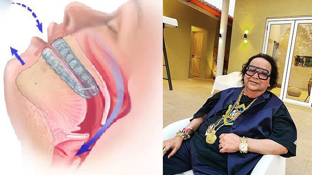 Bappi Lahiri को था Obstructive Sleep Apnea से हुआ | Symptoms जानना आपके लिए भी जरूरी |Boldsky
