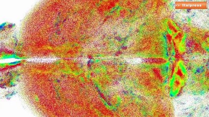 Nuova tecnica ottica HD per studio del cervello