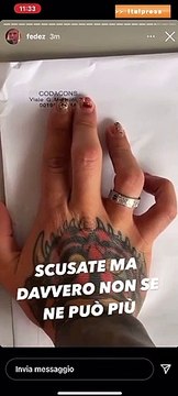 Fedez Stufo di essere perseguitato dal Codacons