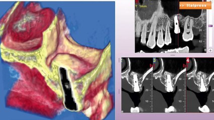 Diagnostica per immagini, così la tecnologia CBCT l'ha trasformata