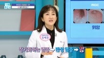 [HEALTHY] The cause of cancer and chronic inflammation?, 기분 좋은 날 220218