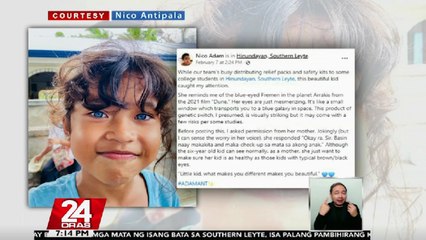 6-anyos na bata sa Southern Leyte, agaw pansin dahil sa taglay nitong asul na mata | 24 Oras
