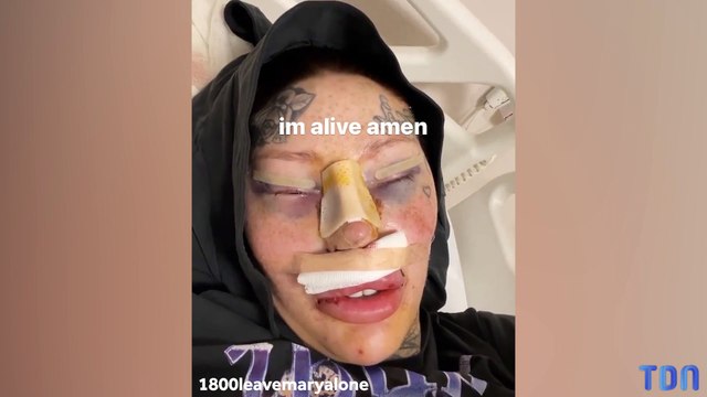 J'ai dépensé plus de 73 000 £ en chirurgie plastique et une opération m'a presque tué