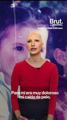 "Soy modelo y tengo alopecia": la historia de Camila Solórzano