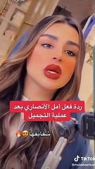 أمل الأنصاري تستعرض شكلها بعد التجميل