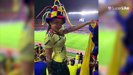 Epa Colombia mostró sus intervenciones faciales