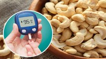 Diabetes Patients के लिए Cashews खाने के जबरदस्त फायदे, जाने क्या है खाने का सही तरीका | Boldsky