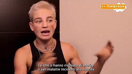 Bebe Vio "In Italia grandi progressi in cultura disabilità"