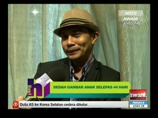 Fizz Fairuz dedah gambar anak selepas 44 hari