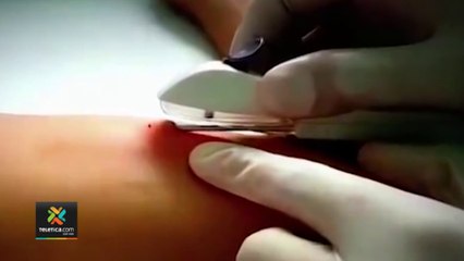 tn7-anticonceptivos-ccss-210222