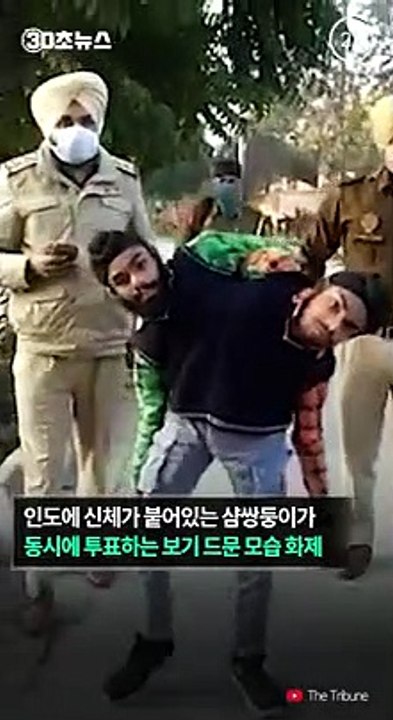 [30초뉴스] 인도 샴쌍둥이, 한명씩 눈가리고 비밀 투표