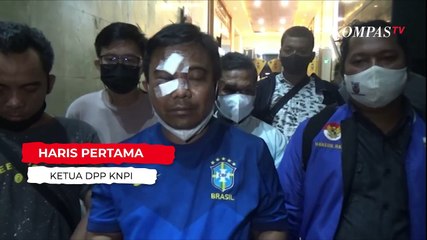 Pengakuan Lengkap Ketum KNPI Dikeroyok Orang Tak Dikenal, Langsung Lapor Polisi!
