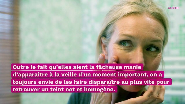 Boutons : ce soin à moins de 10 euros est efficace en une nuit