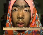 AWANI - Kelantan: Kanak-kanak fizikal istimewa semakin bijak sesuaikan diri di sekolah