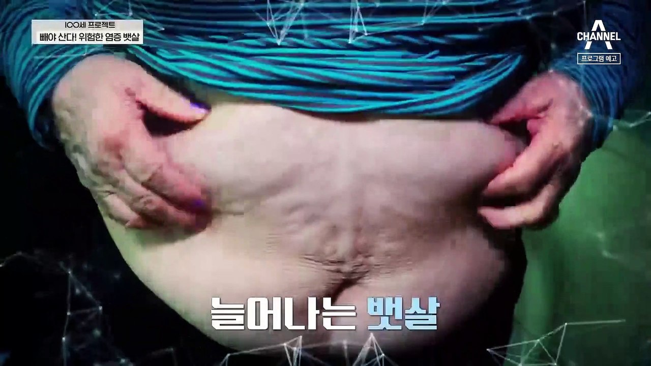 [예고] 빼야 산다! 당신의 건강을 위협하는 염증 뱃살