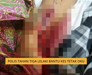 Polis tahan tiga lelaki bantu kes tetak OKU