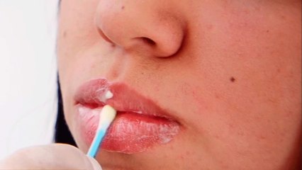 bd-tecnica-de-bb-lips-250222