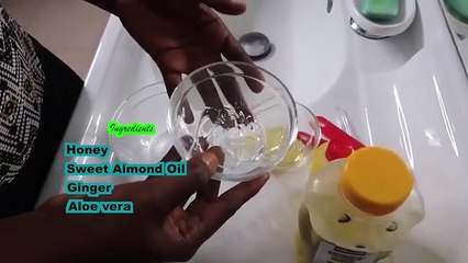 خلطة الزنجبيل للتخلص من حب الشباب والبقع