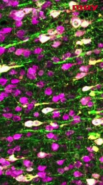 Sonogenética para la activación y control de células vivas