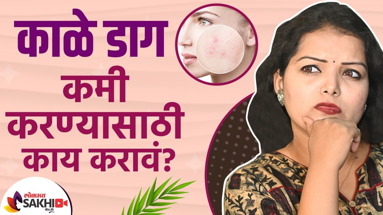चेहऱ्यावरील काळे डाग जाण्यासाठी घरगुती उपाय _ H...