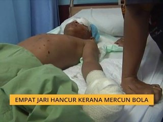 Empat jari hancur kerana mercun bola