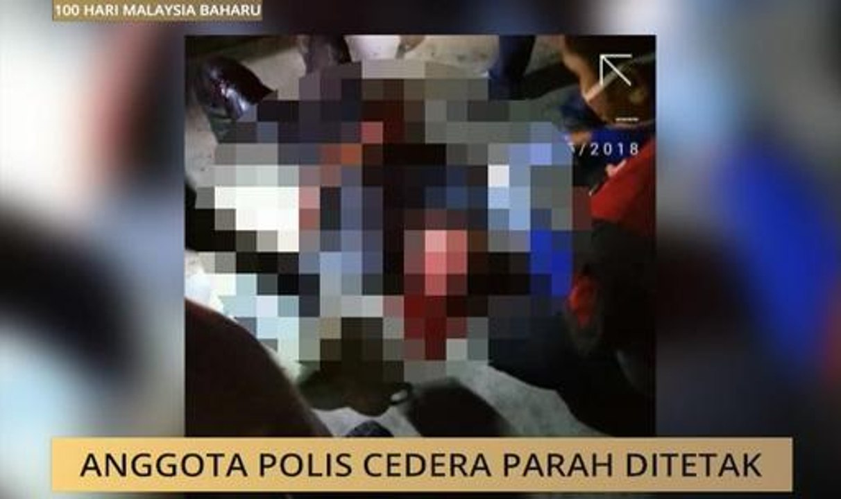Anggota polis cedera parah ditetak