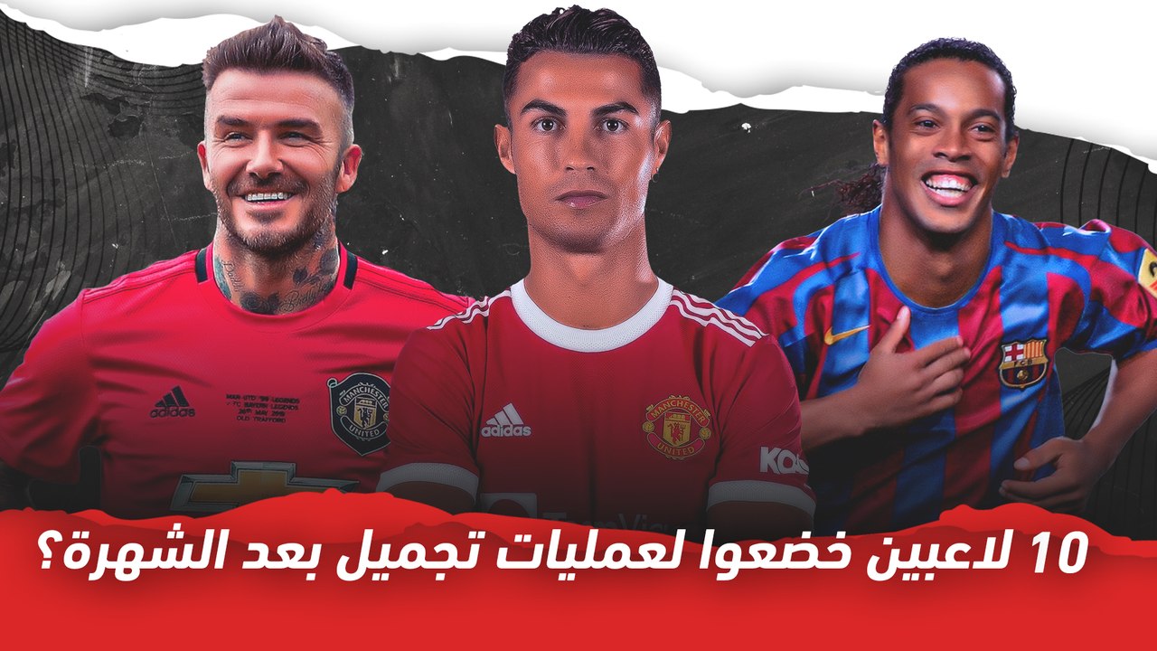 10 لاعبين خضعوا لعمليات تجميل بعد الشهرة؟