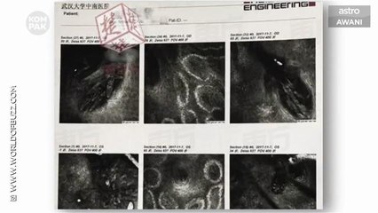 Kompak (Episod 162): 5 tahun tak tukar sarung bantal