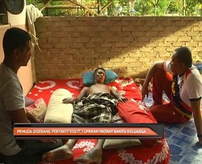 Pemuda diserang penyakit kulit, lupakan hasrat bantu keluarga