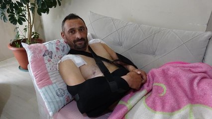 Domuz saldırısından yaralı kurtulan avcı: 'Gidin siz bir de domuzun halini görün'