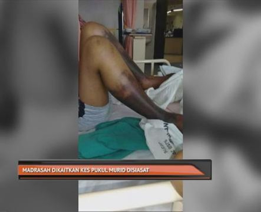 Madrasah dikaitkan kes pukul murid disiasat