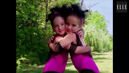 Câlinothérapie : nous vous offrons 50 secondes de douceur