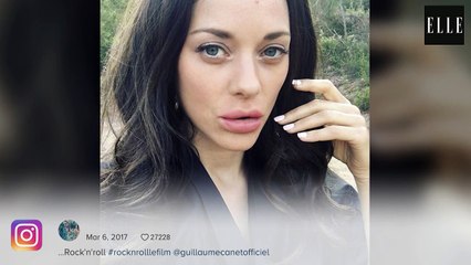 Marion Cotillard, les lèvres gonflées, elle est méconnaissable !