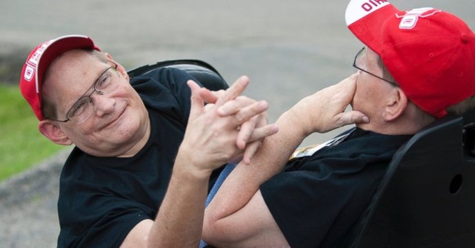 At 68 the world’s oldest living conjoined twins refused to be separated