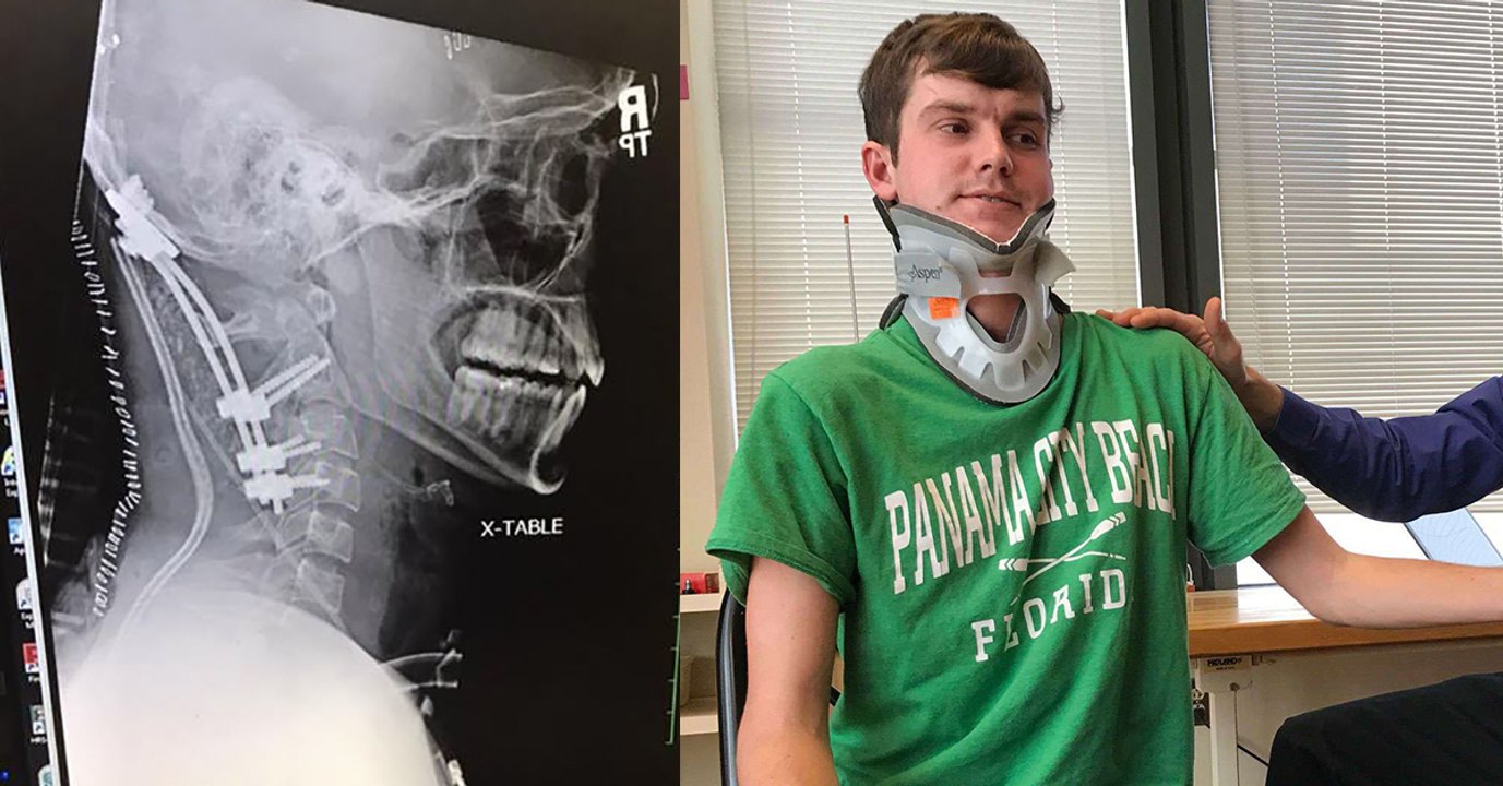 This 22-year-old cheated death by surviving a deadly 'internal decapitation'