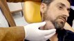 Doctor films the biggest pimple he's ever popped