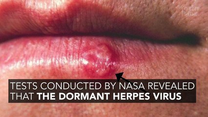 This Is The Surprising Reason So Many Astronauts Are Getting Herpes