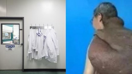 They Removed A 27 Kg Tumour That Had Been Growing On His Back For 30 Years