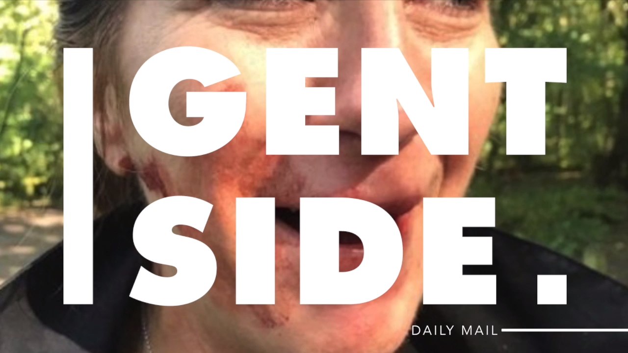 One Dog Walker Got Knocked Out for Having Her Dog Off It's Lead