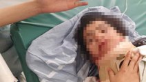 İsrail polisinin attığı ses bombası, 11 yaşındaki çocuğun kafasına isabet etti