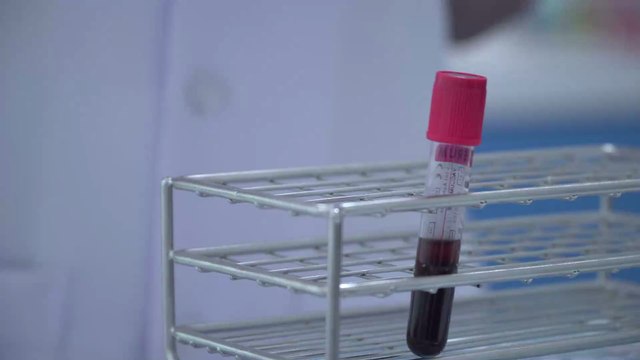 Coronavirus: here are some real ways to protect yourself effectively