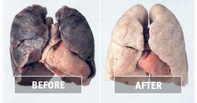 Remove tar and nicotine build-up in your lungs by eating these foods