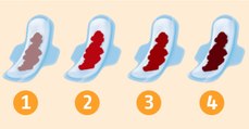 The Colour Of Your Period Blood Says A Lot About Your Health
