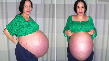 What happened to Octomom? This is what she’s up to 10 years later