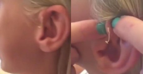 After 6 years, this girl finally got rid of the growth ruining her life