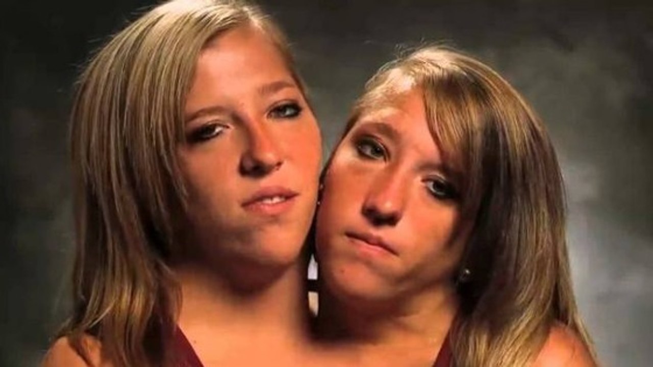 Abigail & Brittany Hensel - The Twins Who Share a Body - video Dailymotion